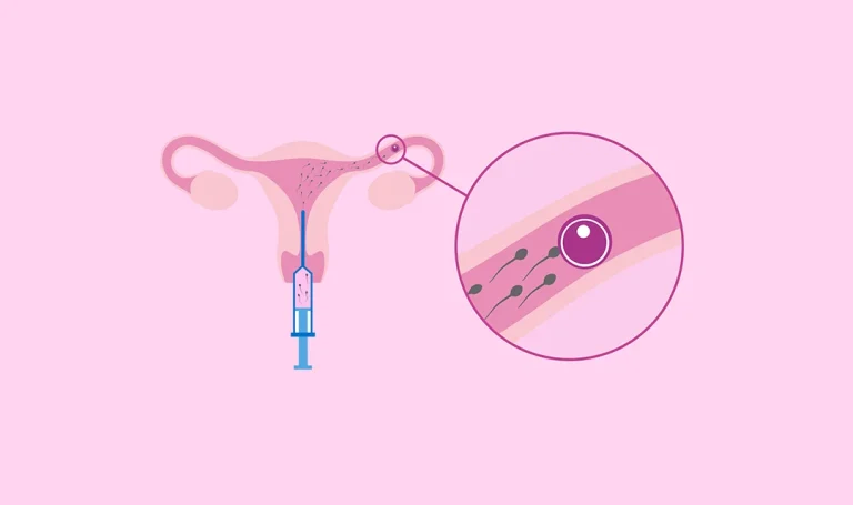 Mitos y realidades sobre la inseminación artificial